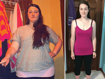Before and after picture of a woman that lost weight to win a weight loss competition